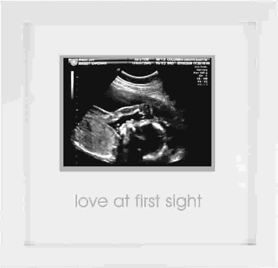 Moldura de ultrassom Pearhead Love at First Sight, chá de bebê ou para pais grávidas, branco