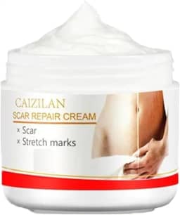 Creme para estrias para mulheres | Adequado para gravidez e pós-parto | Creme anti-estrias | Reparação poderosa para estrias, tratamento para estrias, creme reparador para estrias